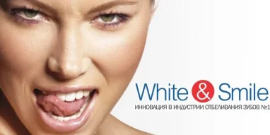Студия косметического отбеливания зубов White&Smile фотография 3